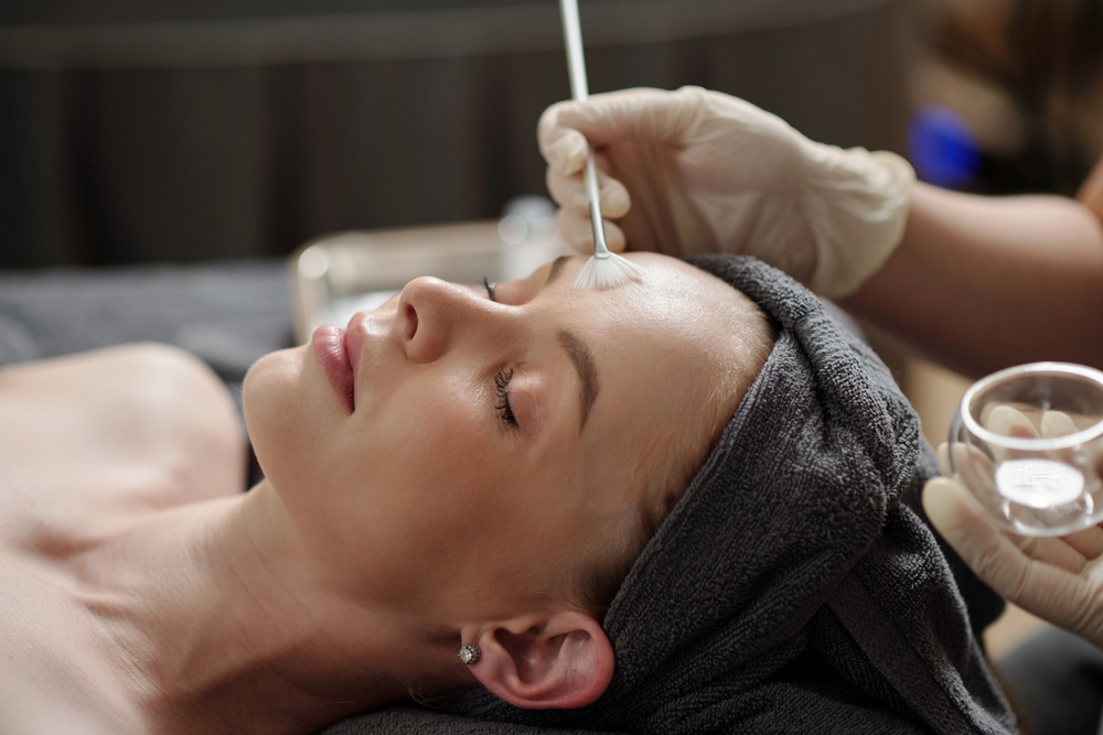 Chemical Peel Facials