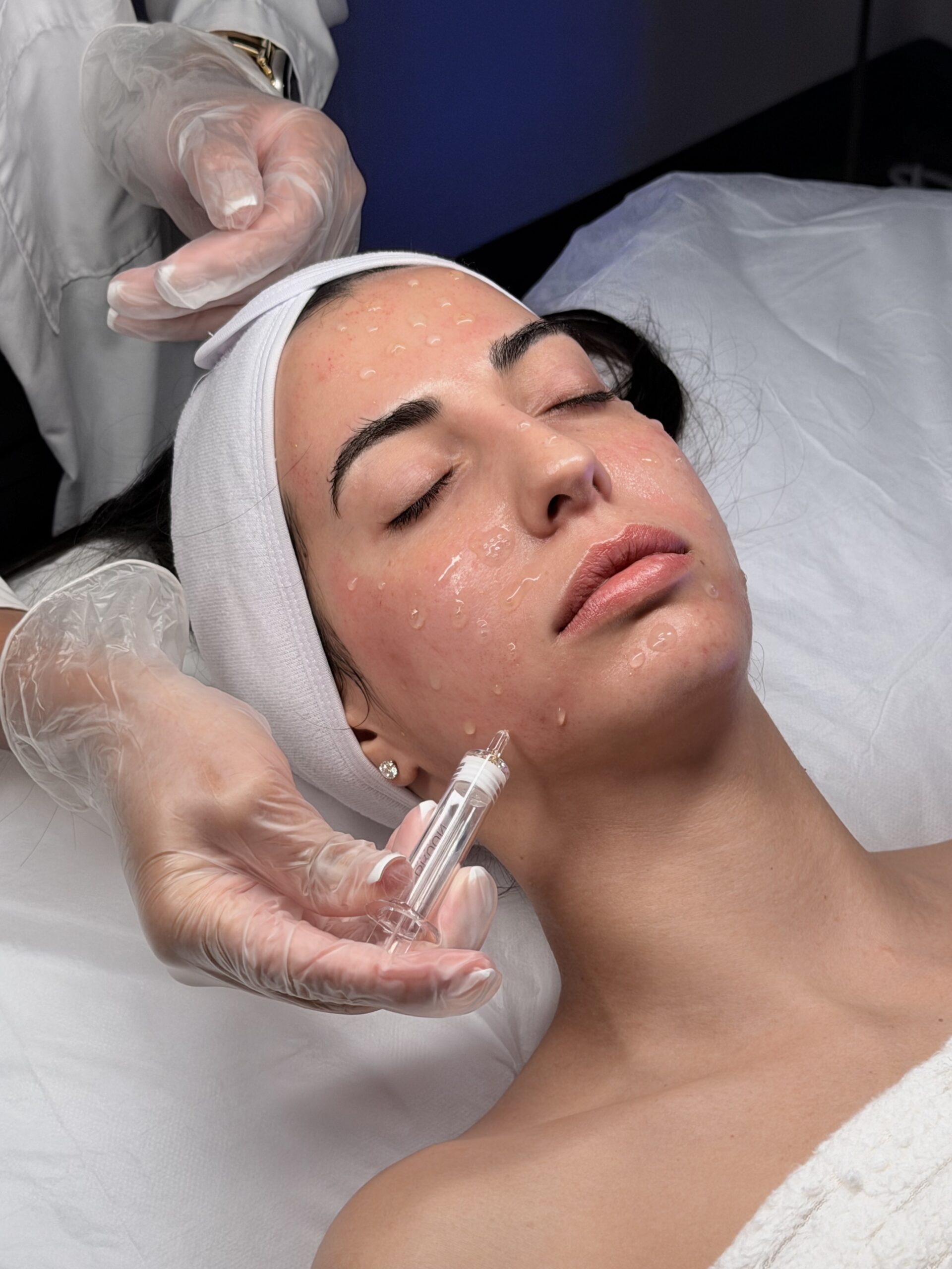 Is microneedling with salmon DNA suitable for all skin types?